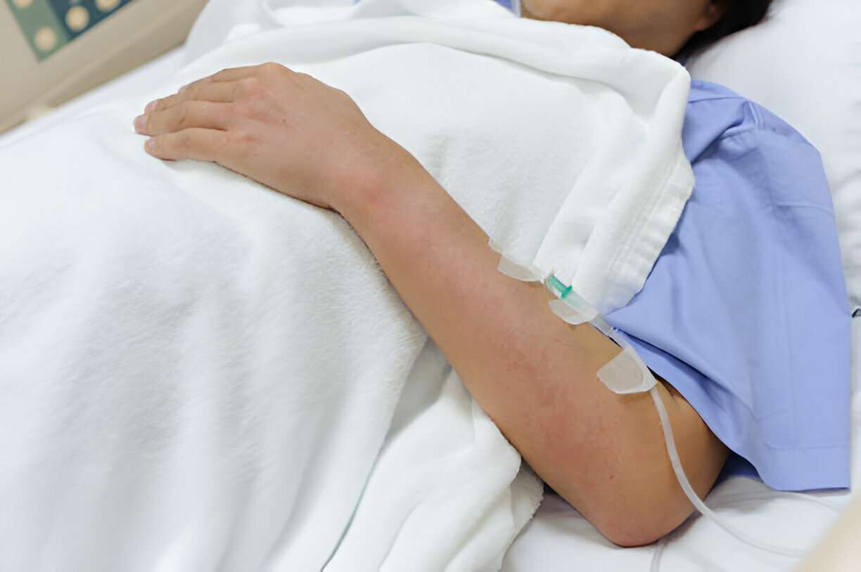 Read more about the article Cara Mengatasi Penyakit DBD